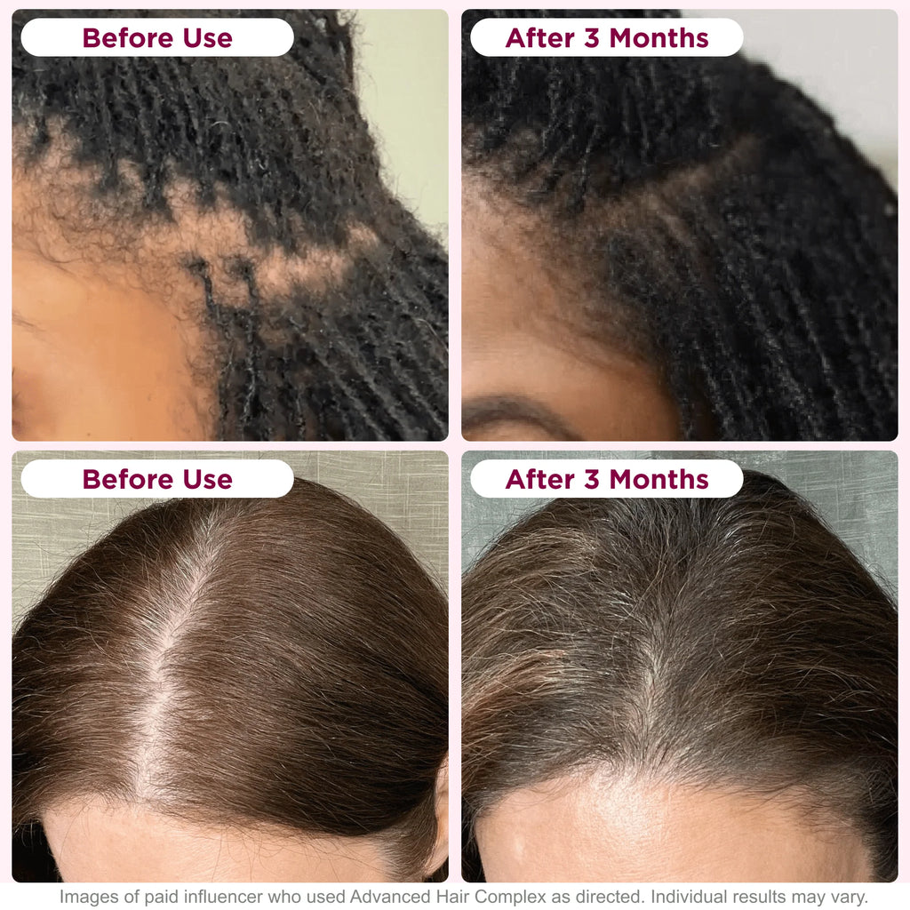 Nature's Bounty Optimal Solutions Hair Growth Supplement for Women with Biotin, 30 Capsules A372744