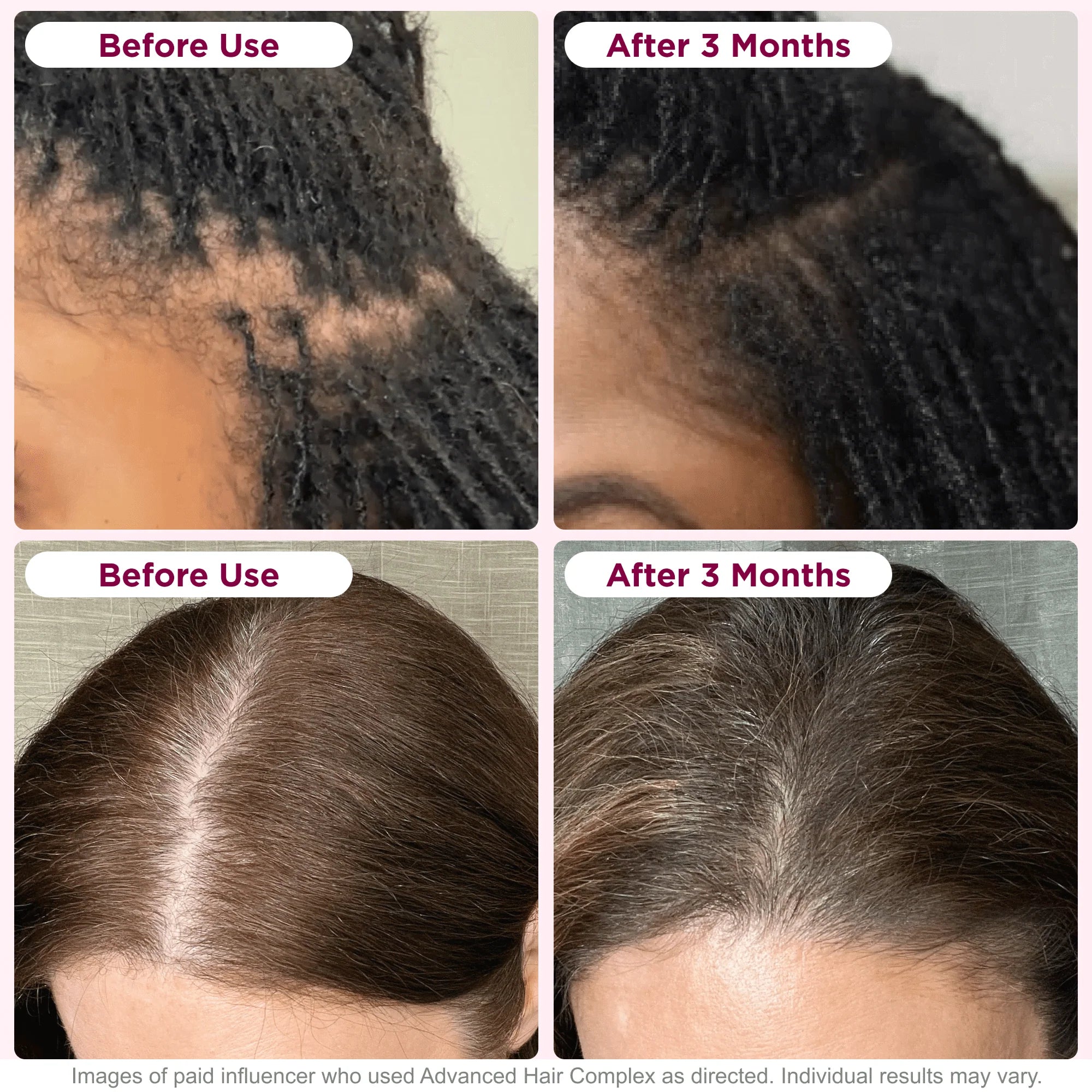 Nature's Bounty Optimal Solutions Hair Growth Supplement for Women with Biotin, 30 Capsules A372744